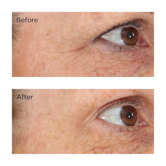 Perricone MD Essential Fx Acyl-glutathione Eyelid Lift Serum 0.5 Oz All Skin New - Picture 3 of 3